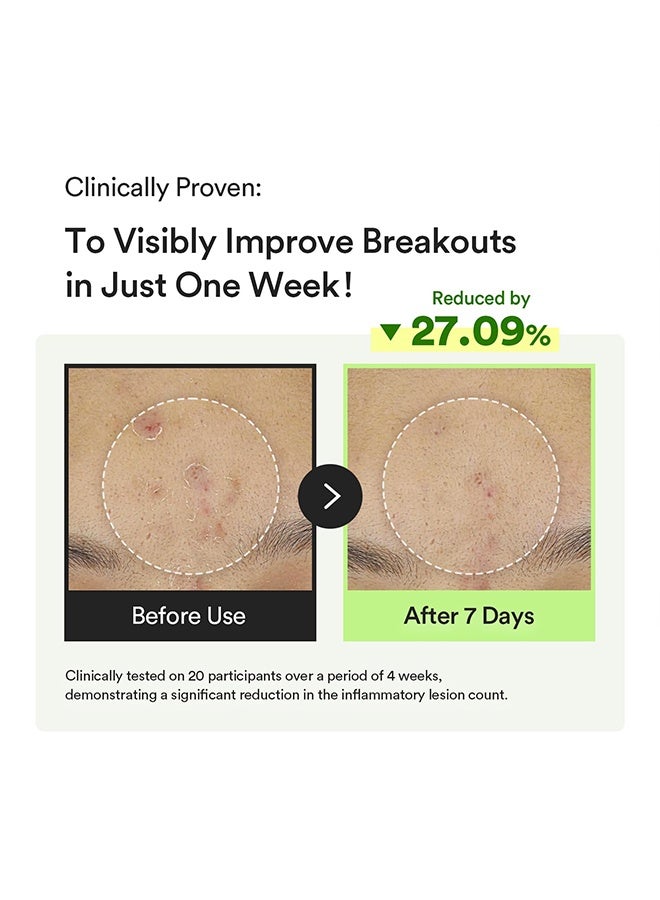 ابيب سيروم كبسولة هارتليف TECA، قطرات مهدئة ومرطبة مع سنتيلا آسياتيكا ونياسيناميد | عناية كورية خفيفة للبشرة الحساسة - Image 5